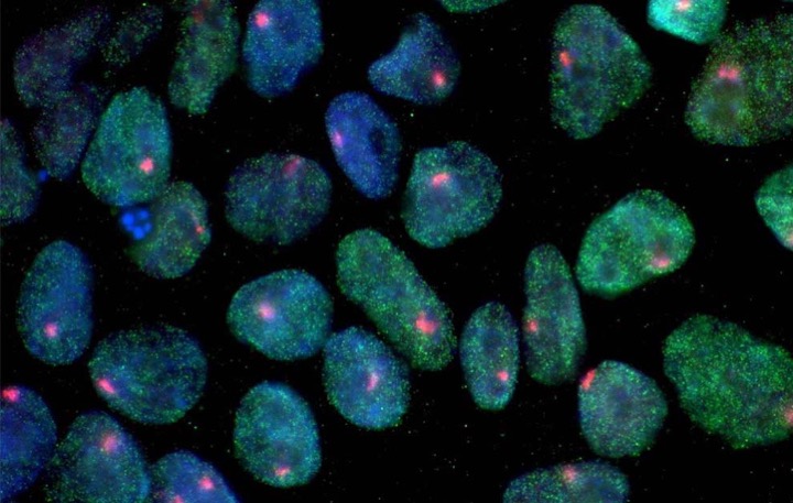 Image of blue and green stem cells from the California Institute for Regenerative Medicine (CIRM)